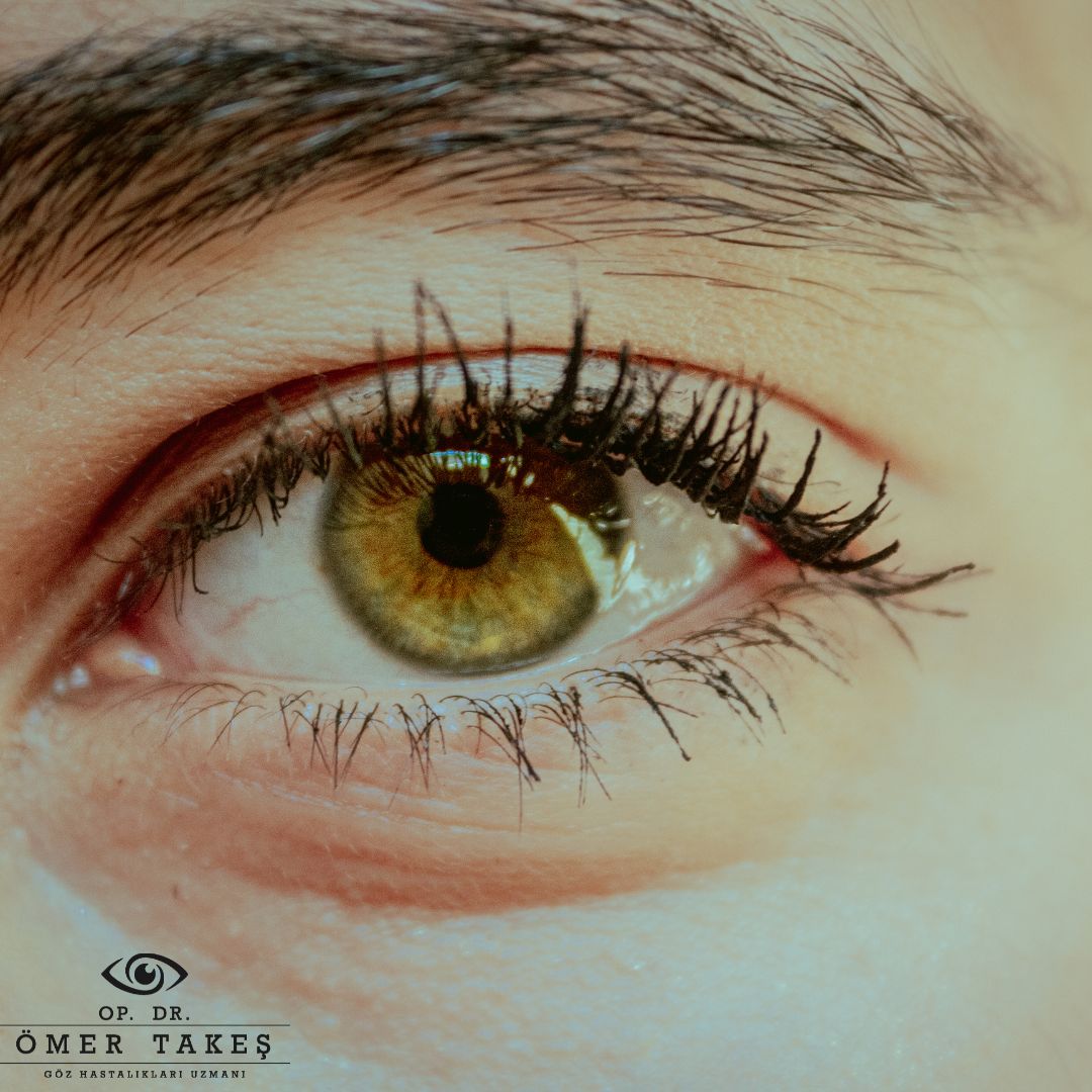 Göz Altları Neden Şişer