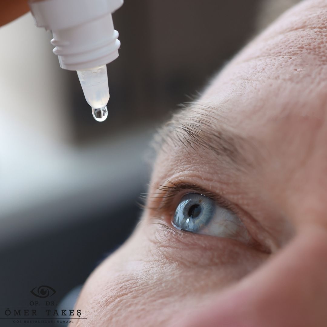 Göz Damlası Nasıl Kullanılır