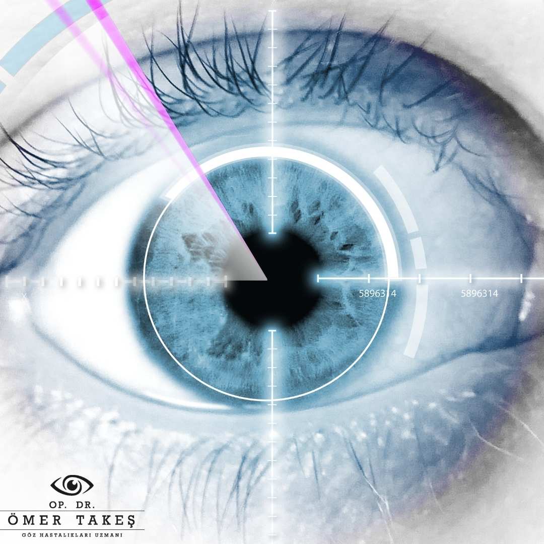 LASIK Lazer Göz Ameliyatı Yaptıranların Yorumları