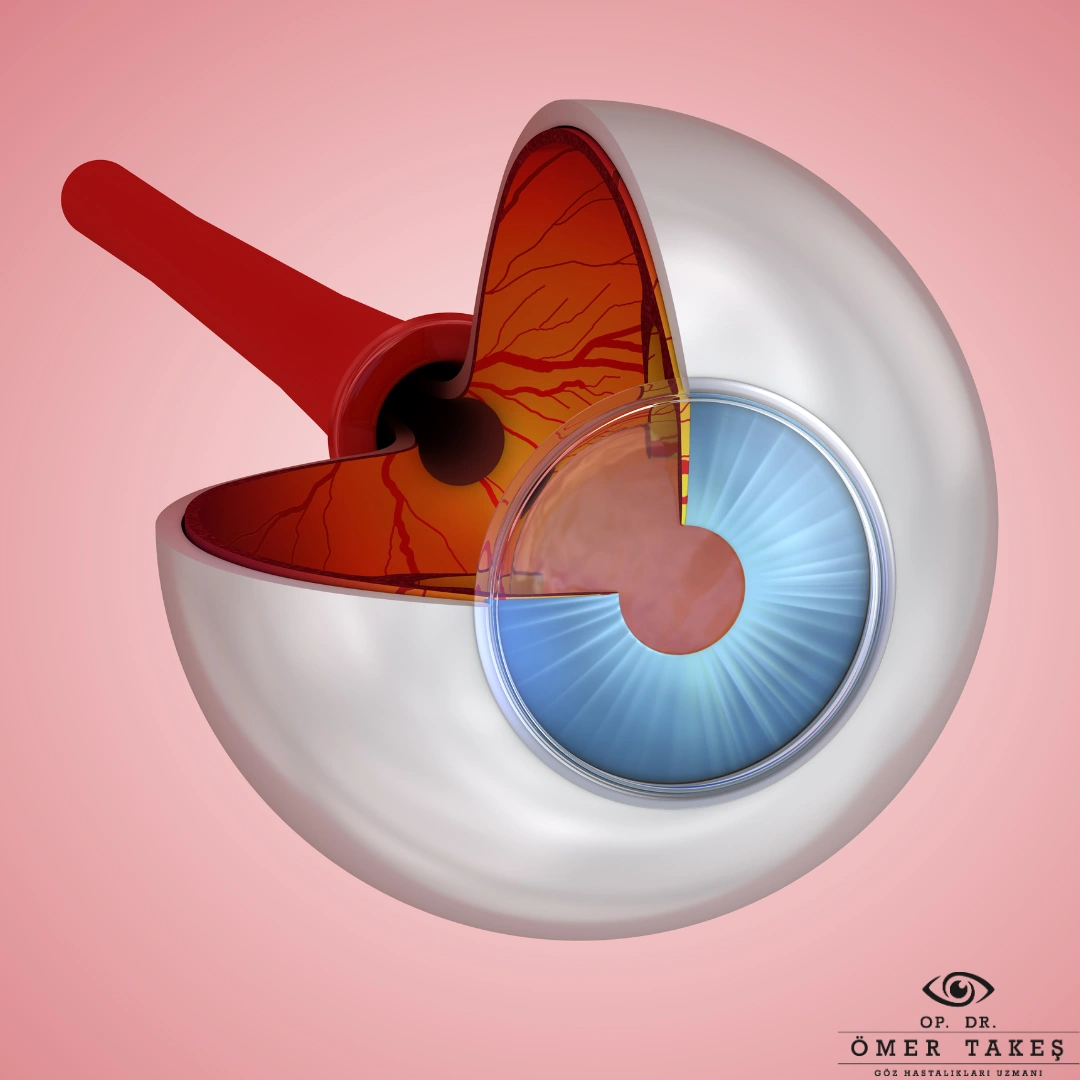 Miyop Neden Olur, ilerlemesi nasıl durdurulur?