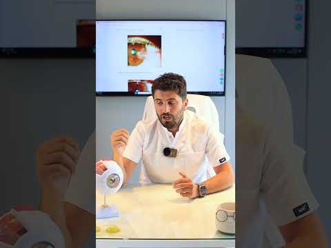 Pterjium hastalığı tekrarlar mı?