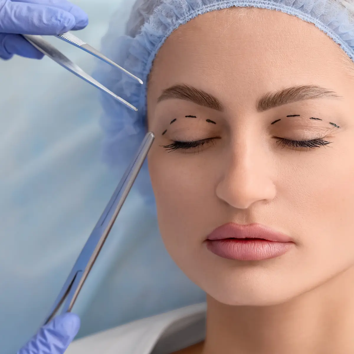 Göz Kapağı Ameliyatı Olanların Yorumları