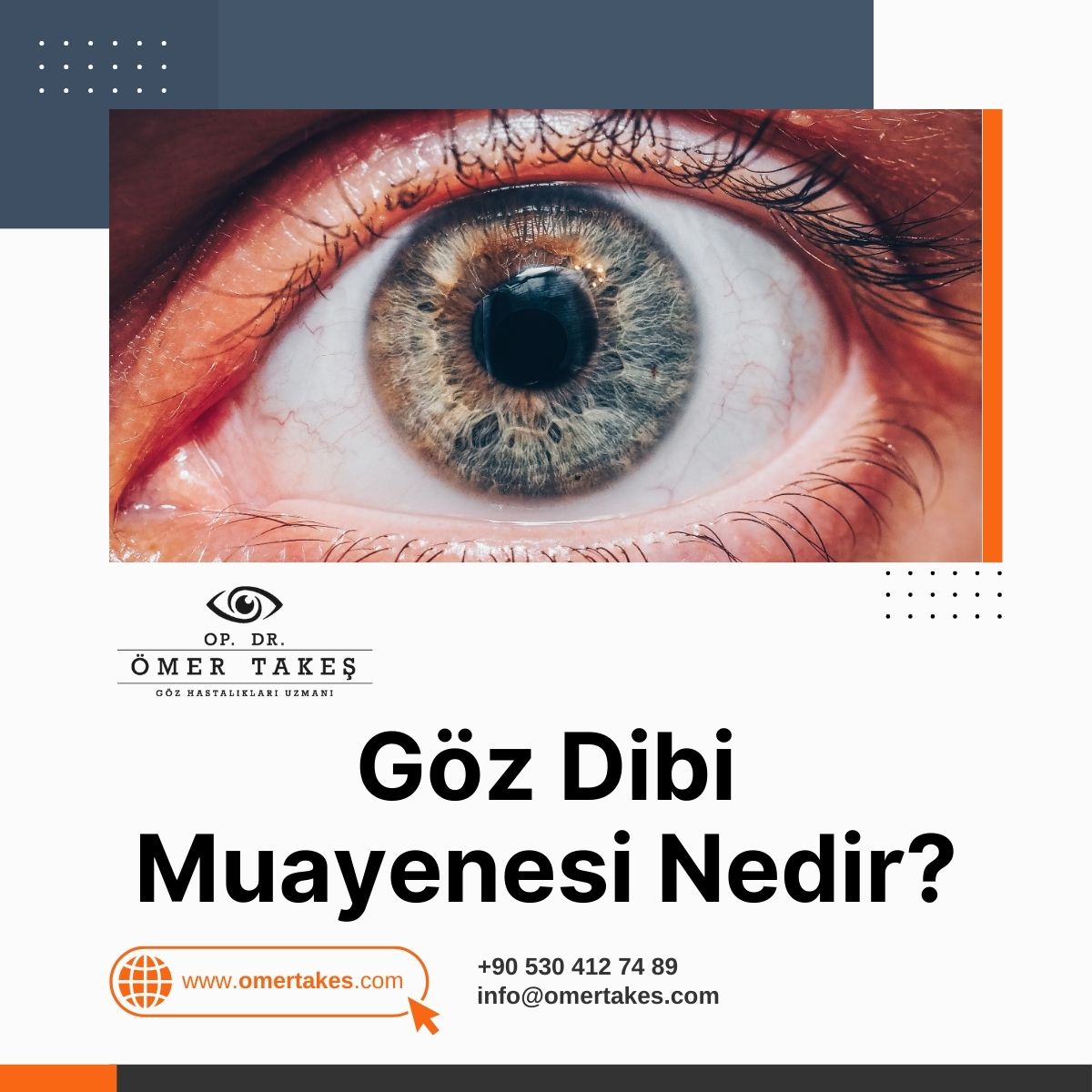 Göz Dibi Muayenesi Nedir