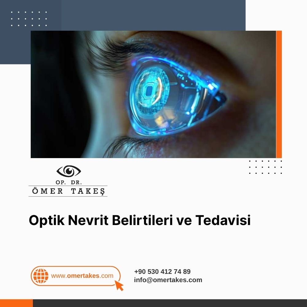 Akıllı Lens Taktıranlar