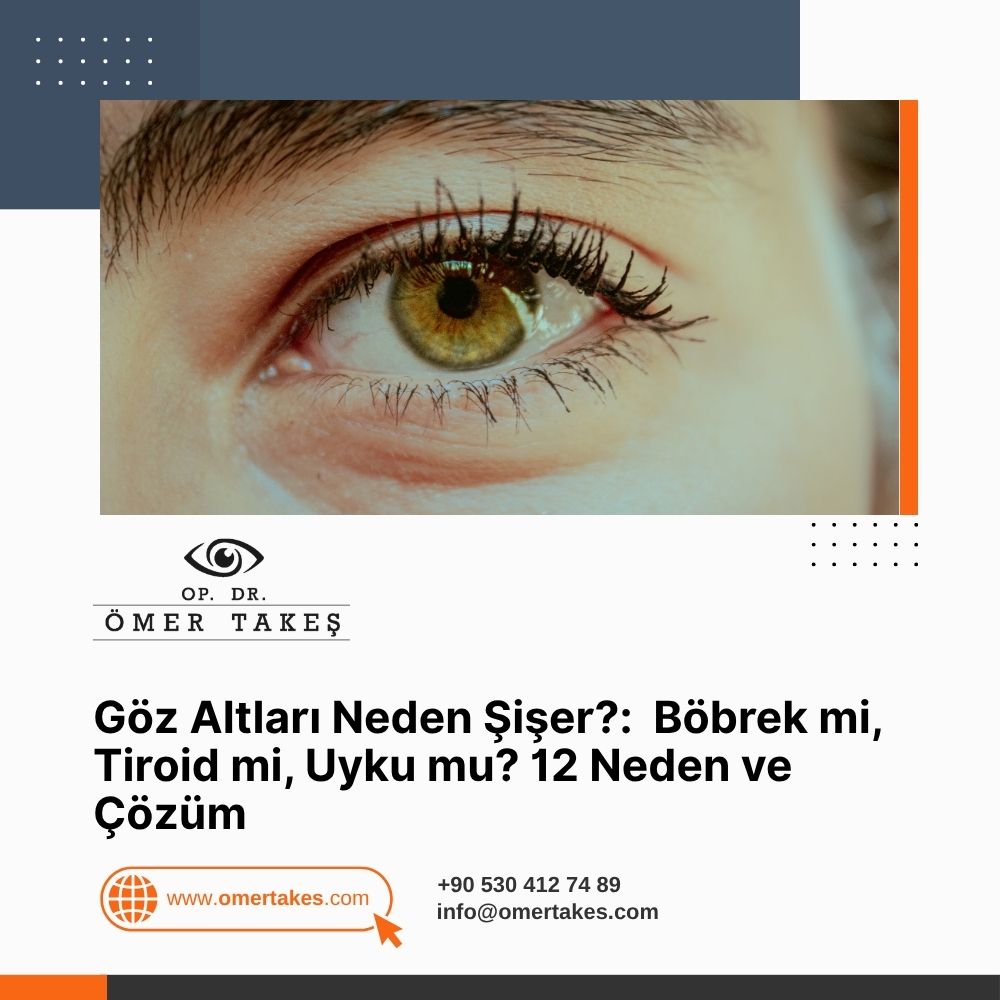 göz altı şişmesi neden olur