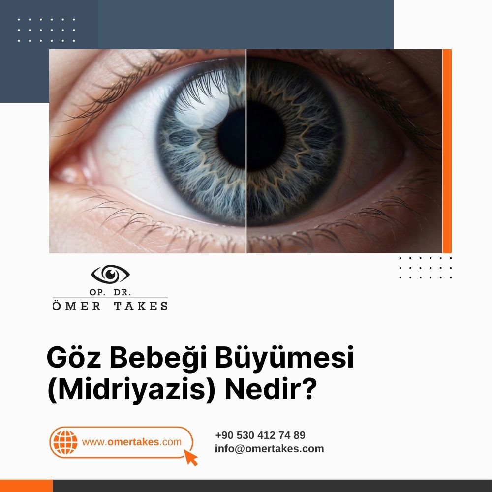 Göz Bebeği Büyümesi (Midriyazis) Nedir