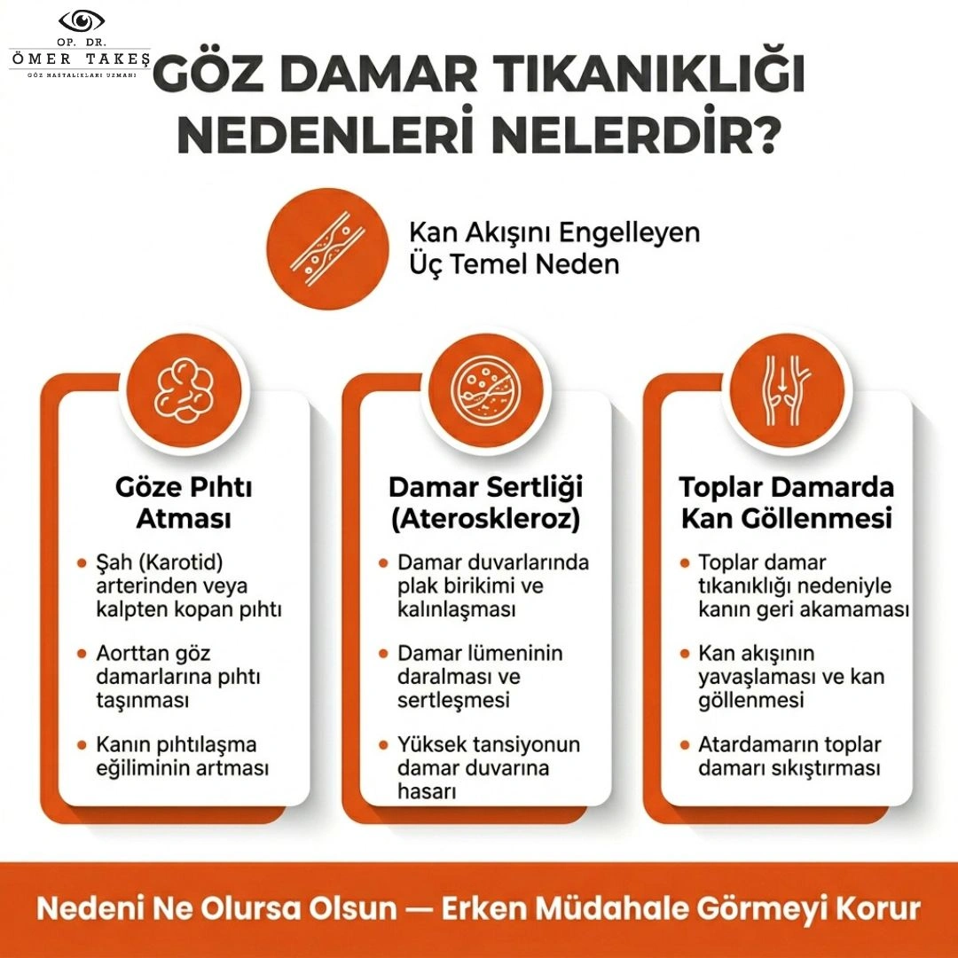 göz damar tıkanıklığı nasıl açılır