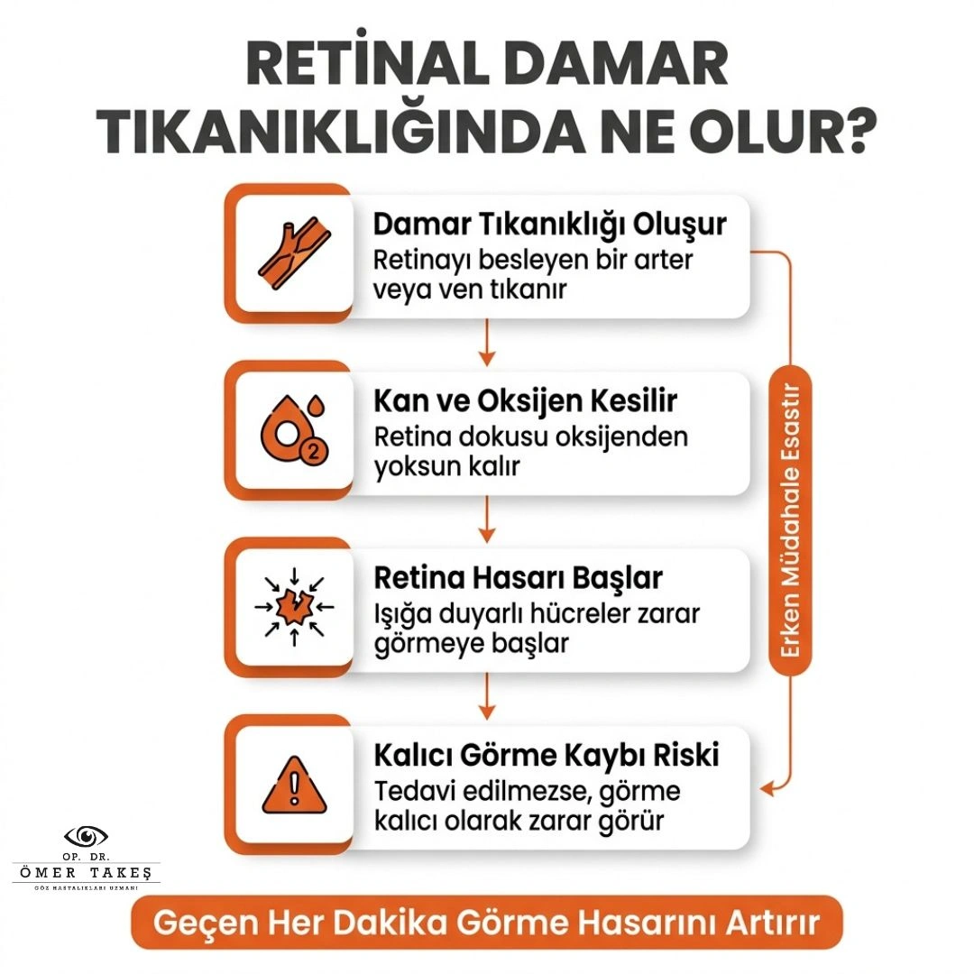 gözde damar tıkanıklığı tedavisi