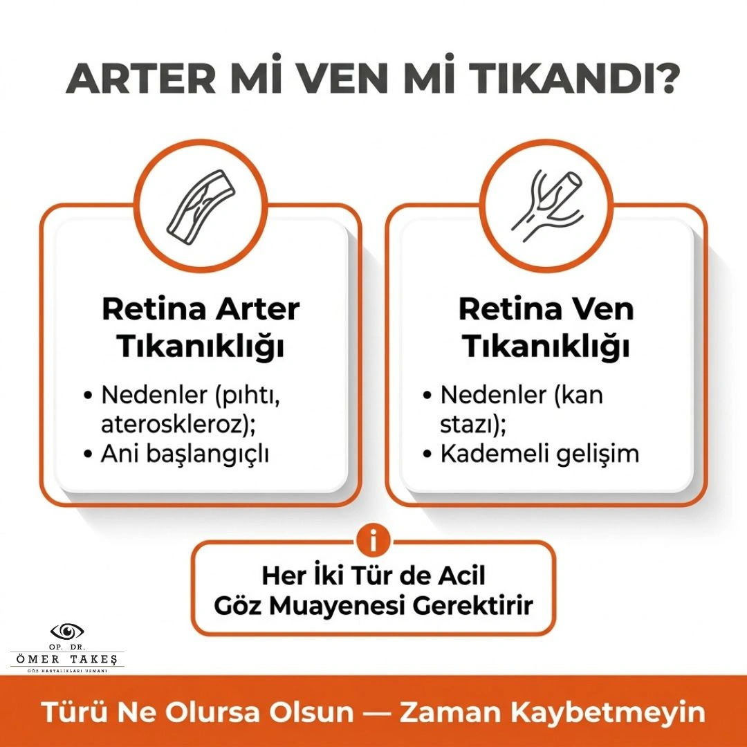 göz damar tıkanıklığı nasıl geçer
