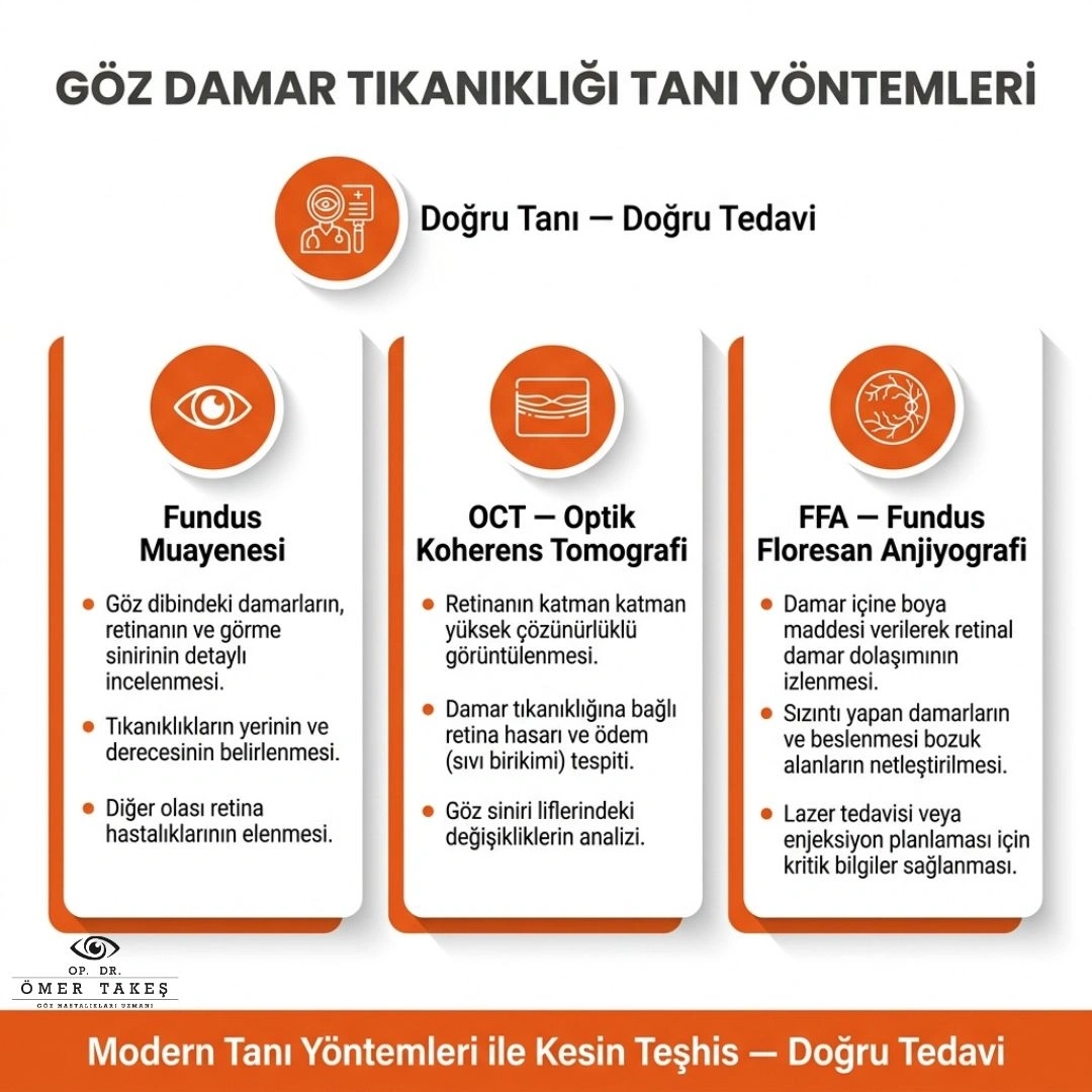 göz damarları neden tıkanır