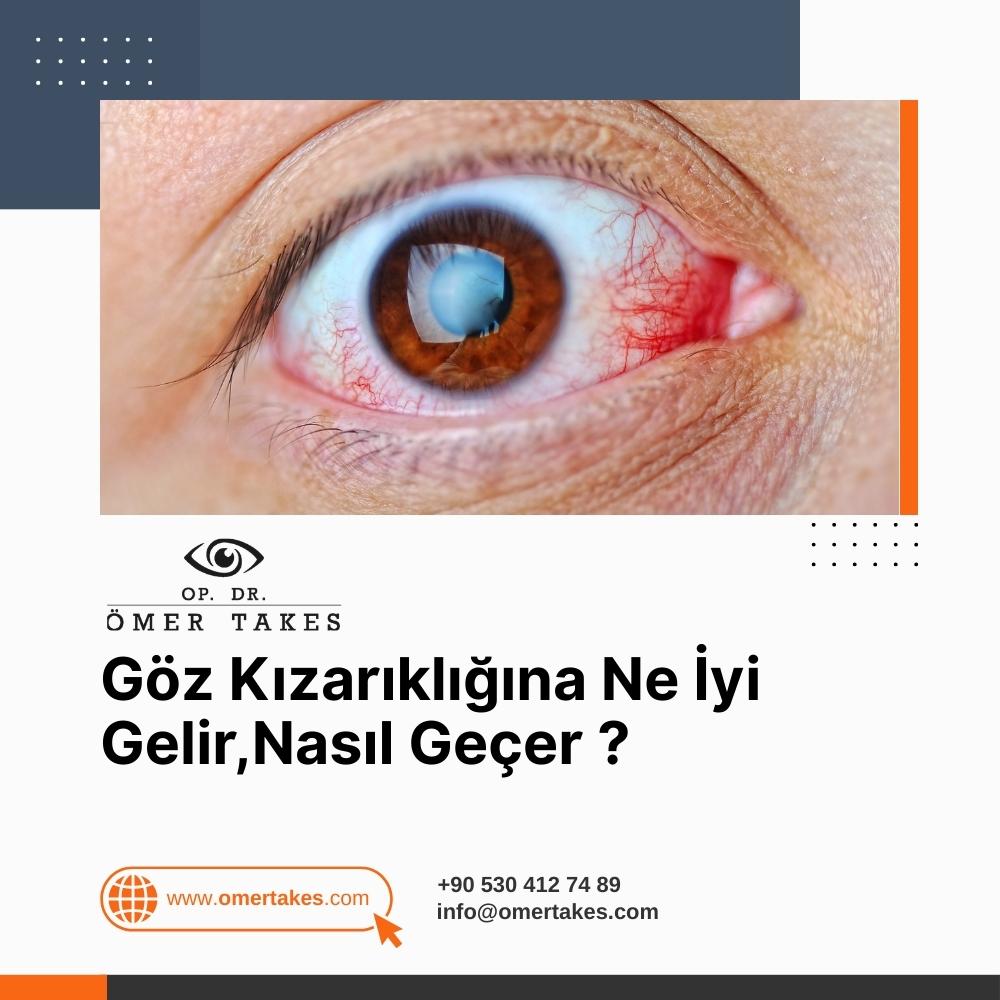 Göz Kızarıklığına Ne İyi Gelir
