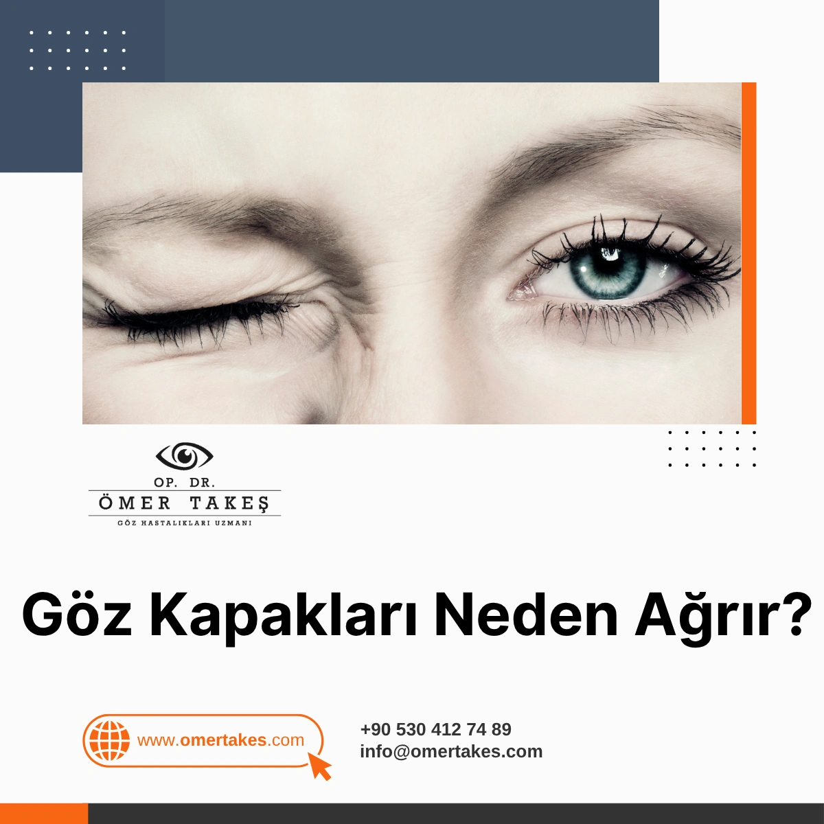 göz kapağı ağrısı ve şişmesi