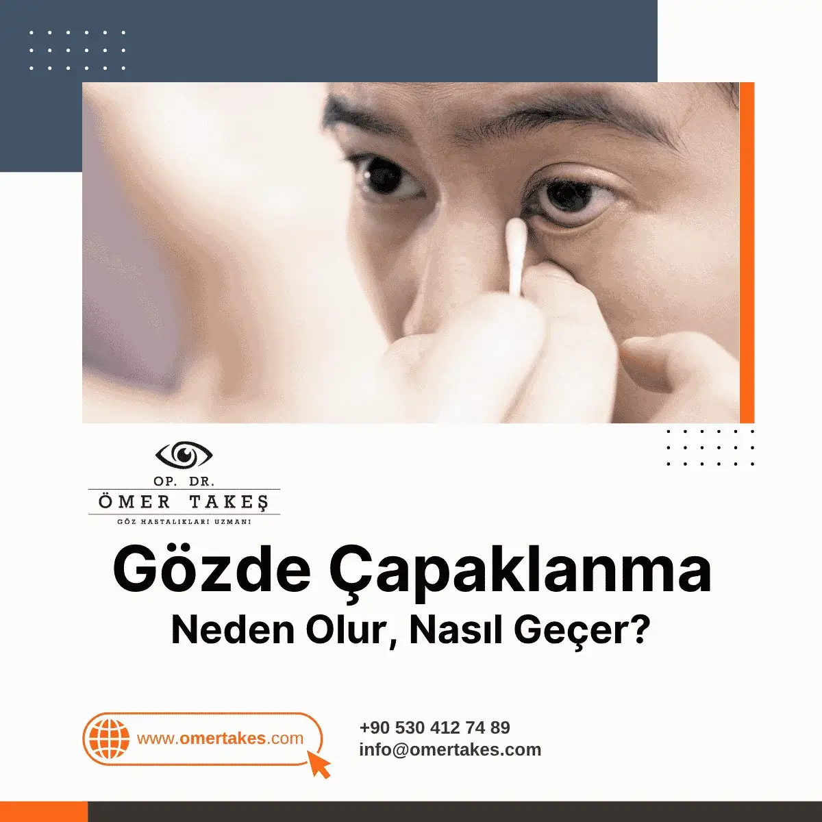 gözde çapaklanma nedenleri