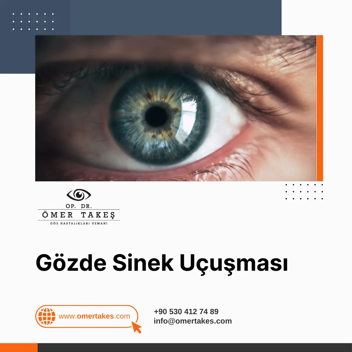 gözde hareketli cisimler