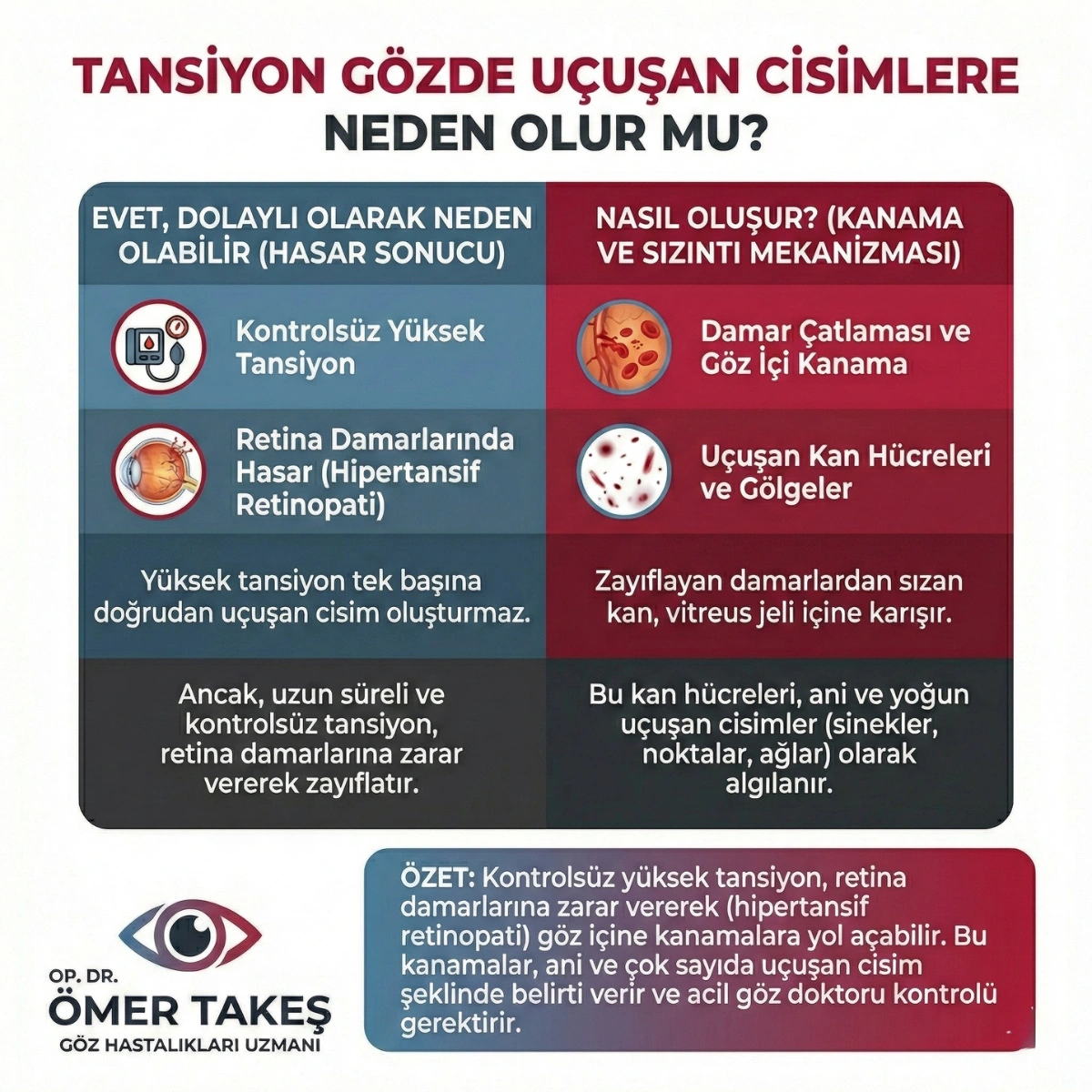 gözde iplik gibi şeyler gelmesi