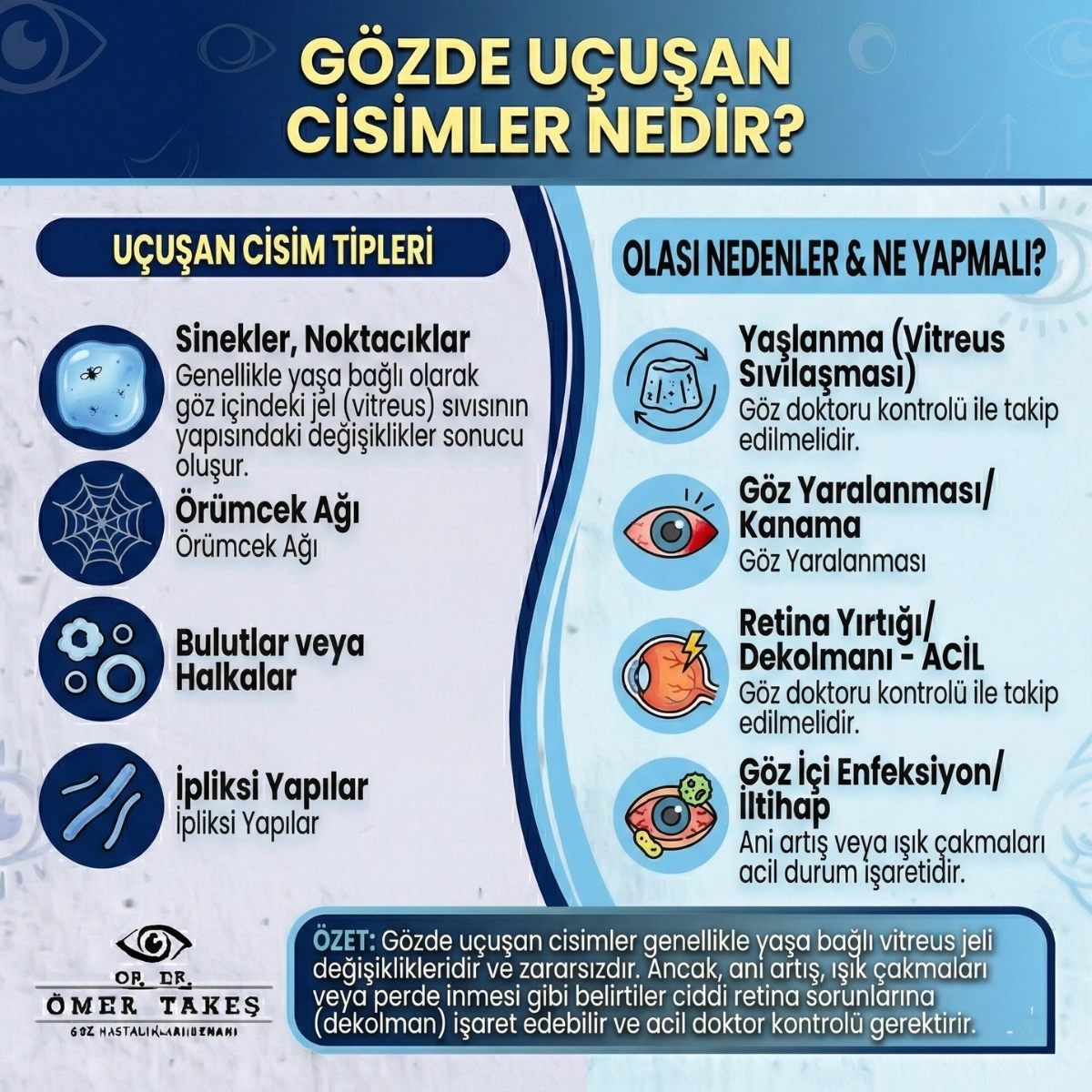 gözde uçuşan cisimler
