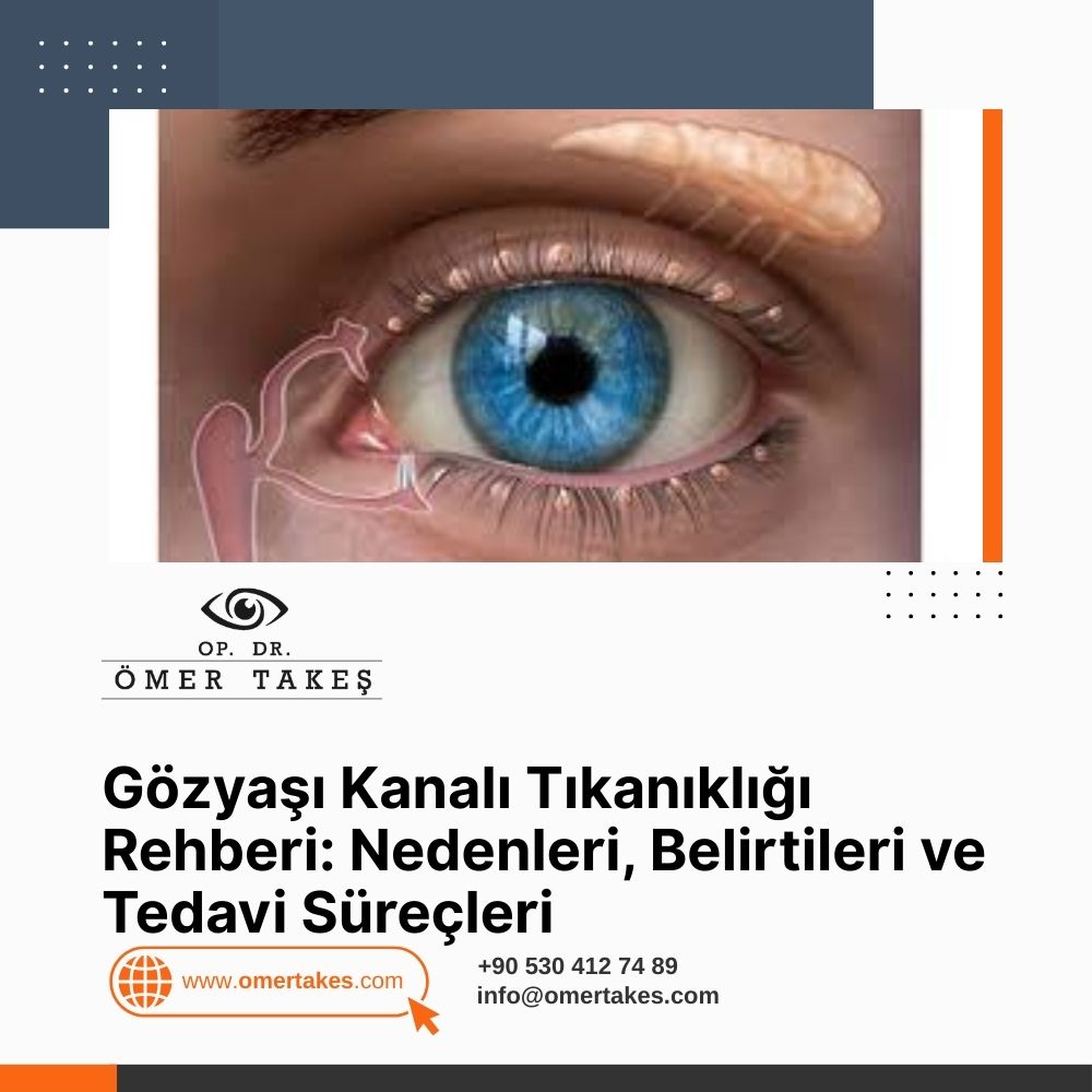 Gözyaşı Kanalı Tıkanıklığı