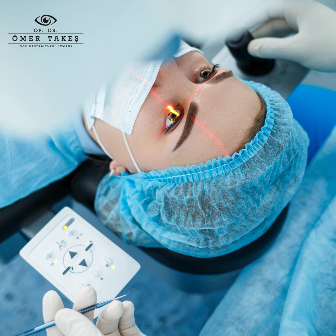 Fakoemülsifikasyon Ve Femto Lazer Süre Karşılaştırması