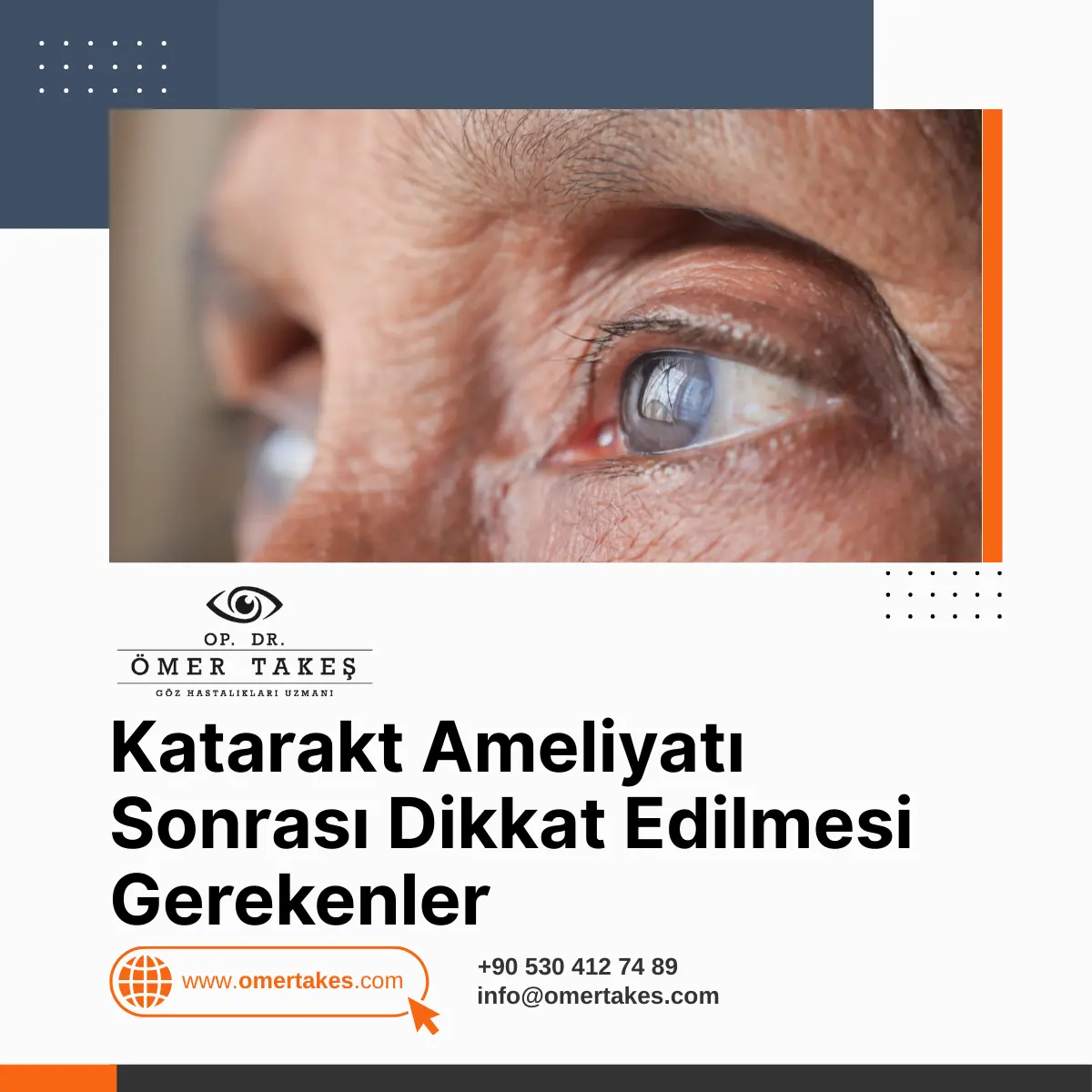 Katarakt ameliyatı sonrası dikkat edilmesi gerekenler