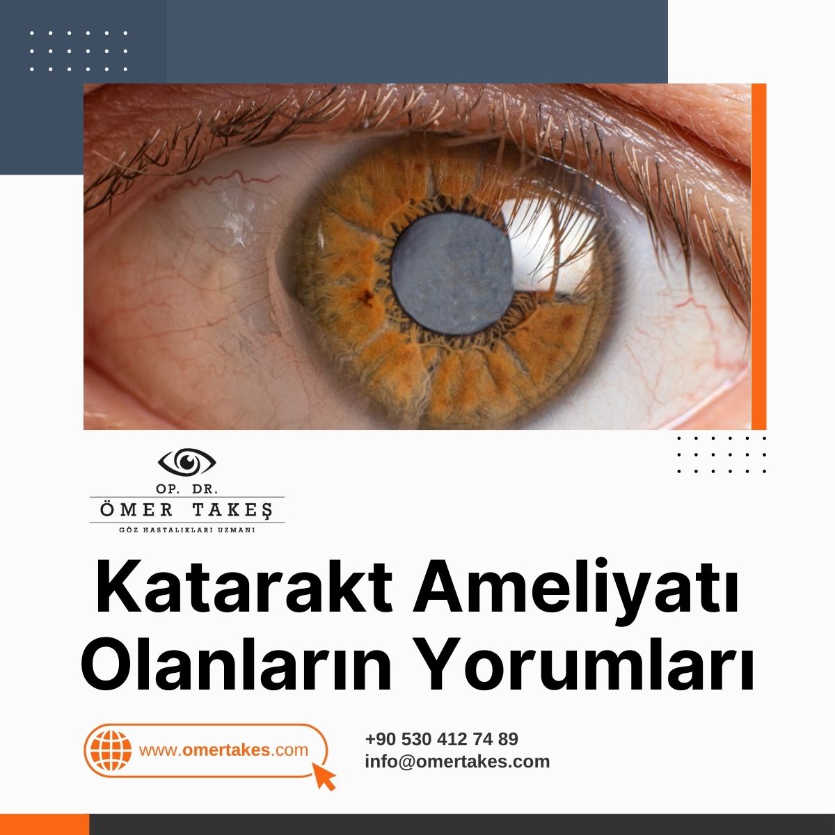 Katarakt ameliyatı olanlar Kadınlar Kulübü