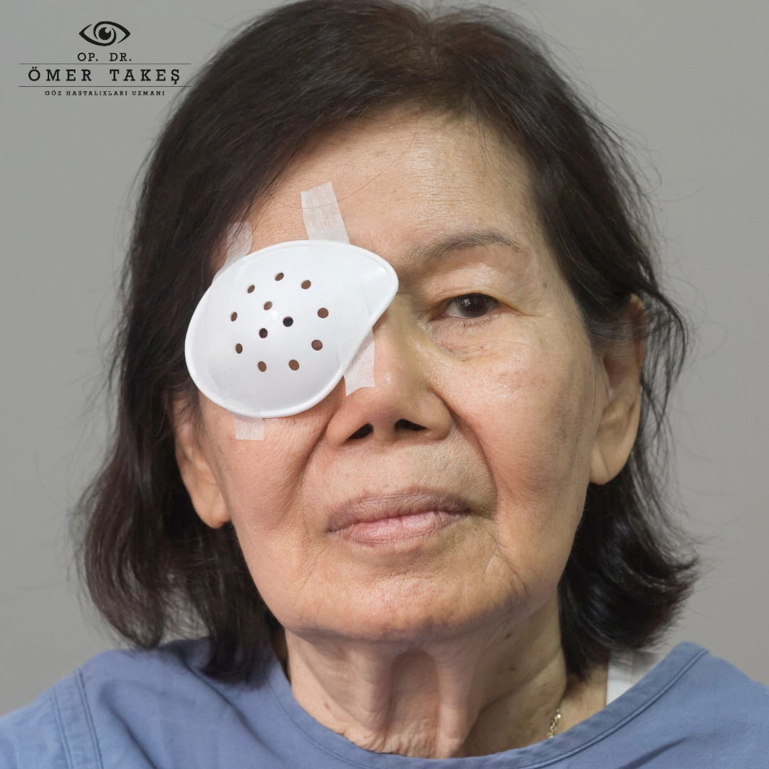 katarakt  Ameliyat Sonrası Günlük Yaşam Zaman Çizelgesi