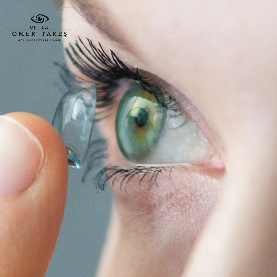 Keratokonus tedavisinde Lens mi, ameliyat mı tercih edilmeli?