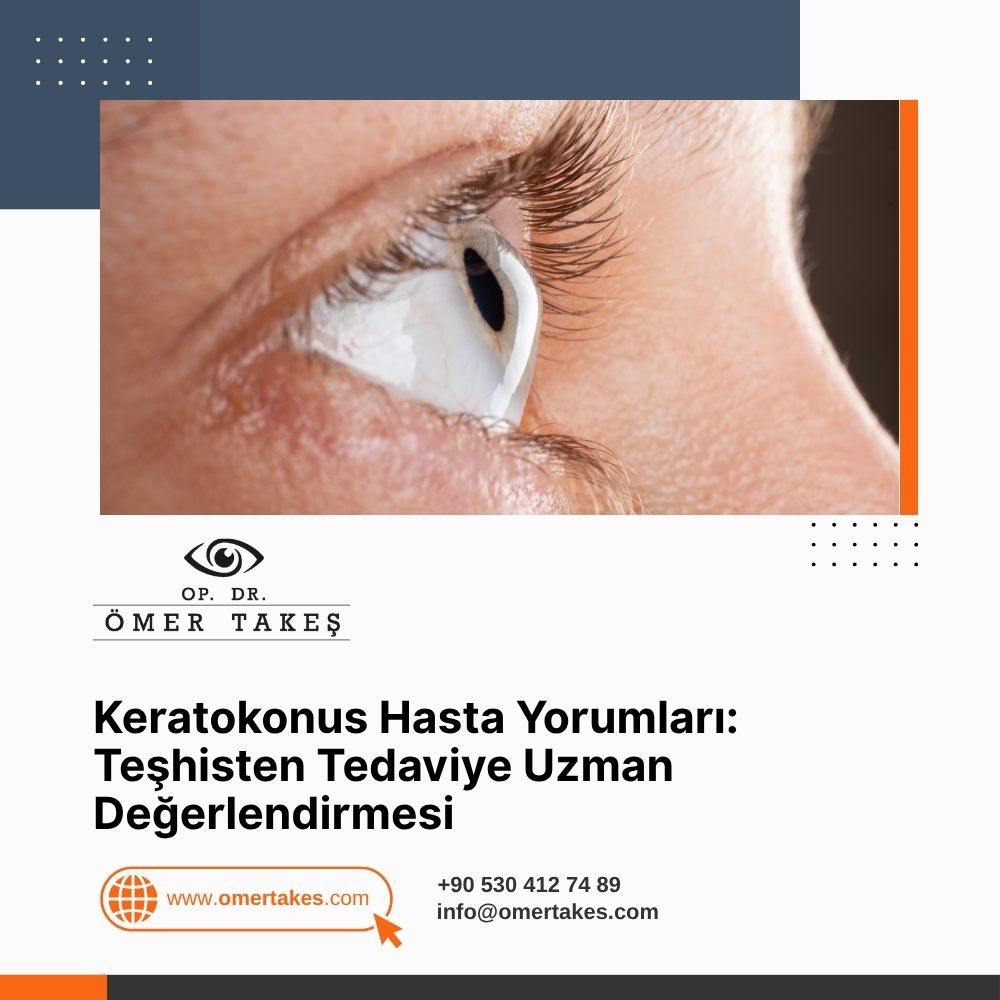 Keratokonus ameliyatı olanlar yorumları Kadınlar Kulübü