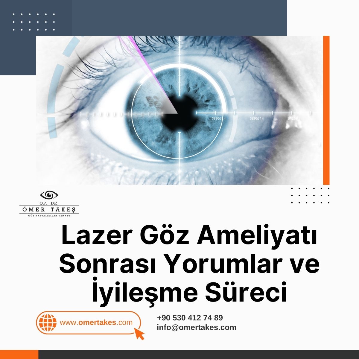 Lazer Göz Ameliyatı Sonrası Yorumlar