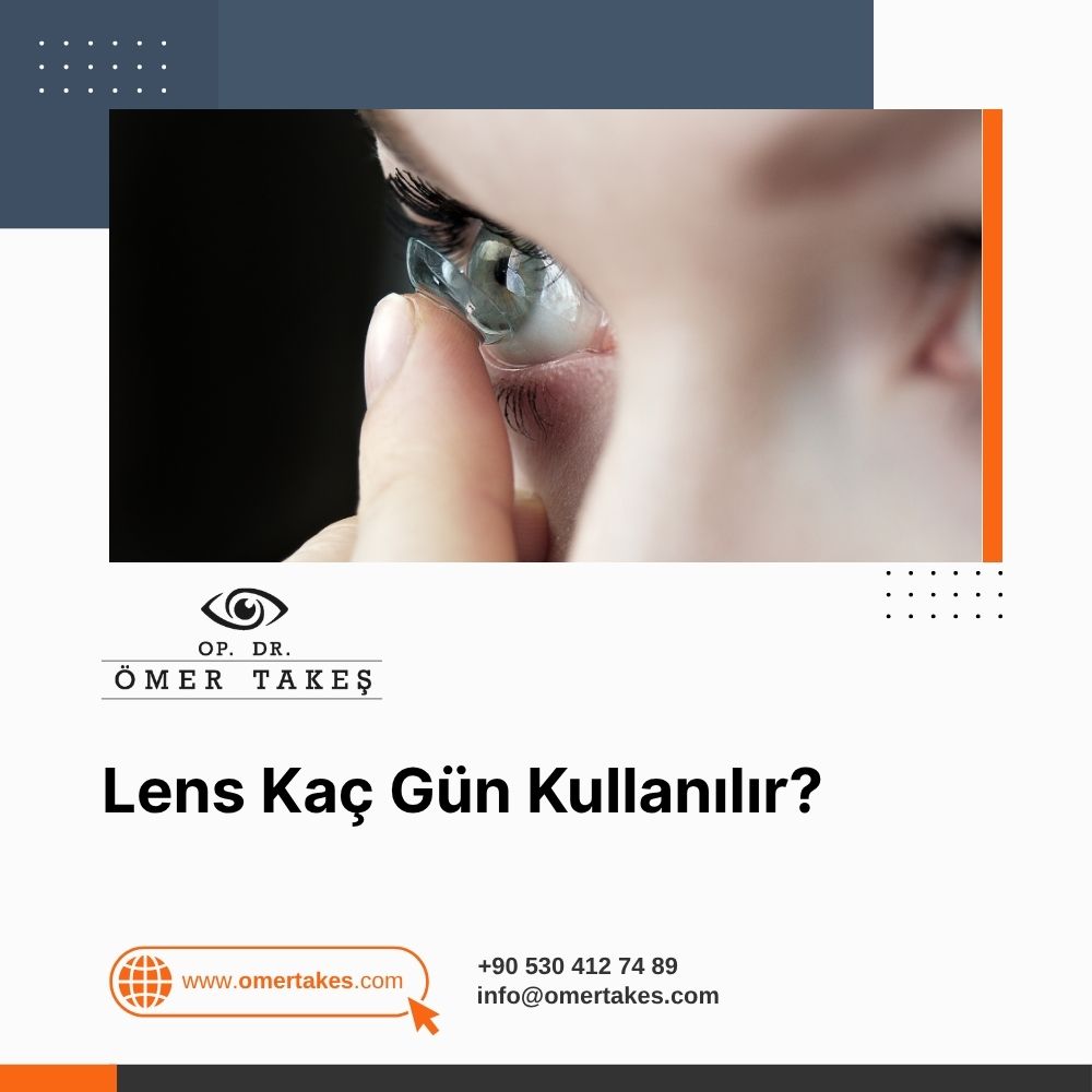 Lens Kaç Gün Kullanılır