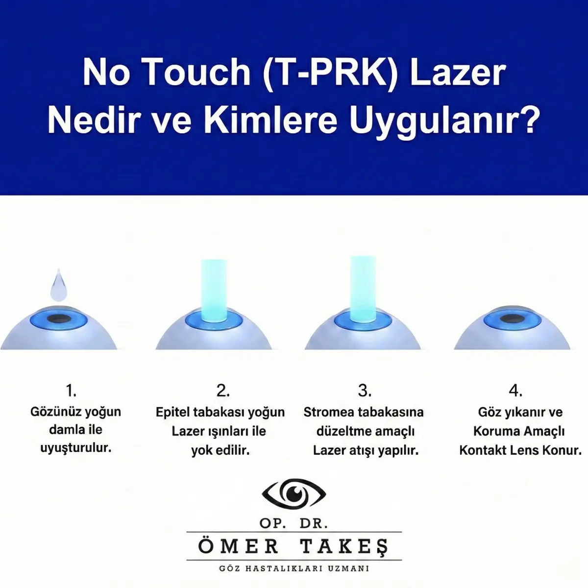 no touch lazer sonrası