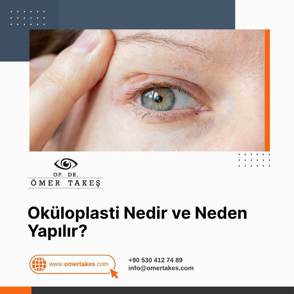 Oküloplasti Nedir ve Neden Yapılır