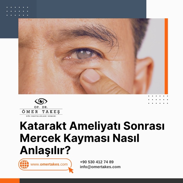 Katarakt Ameliyatı Sonrası Mercek Kayması Nasıl Anlaşılır?
