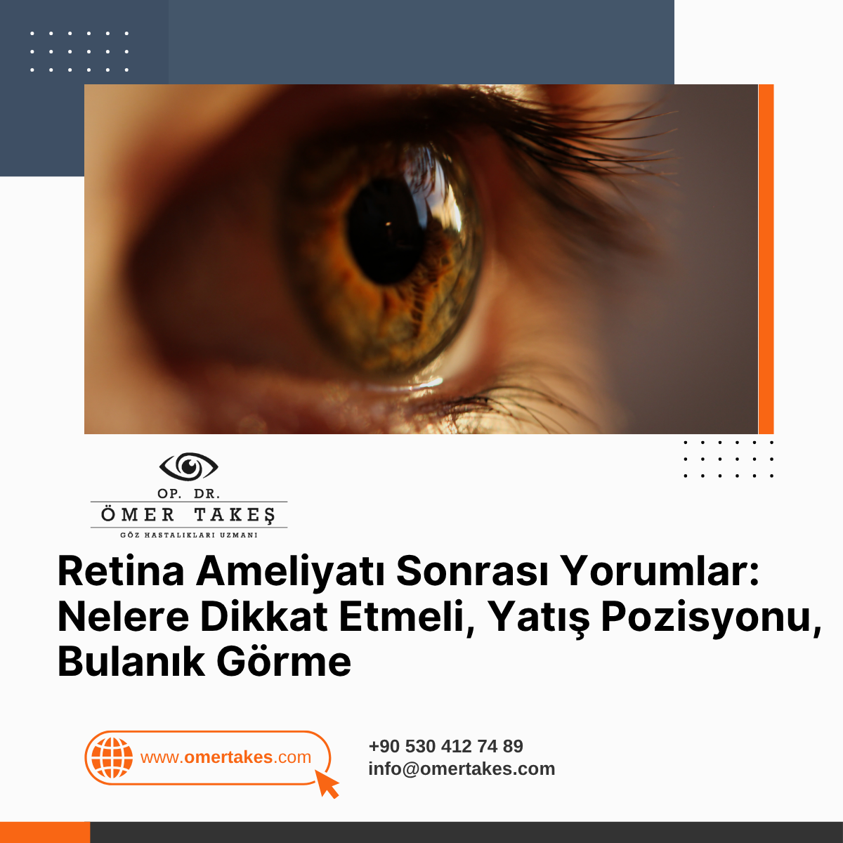 retina ameliyatı sonrası yorumlar kadınlar kulübü