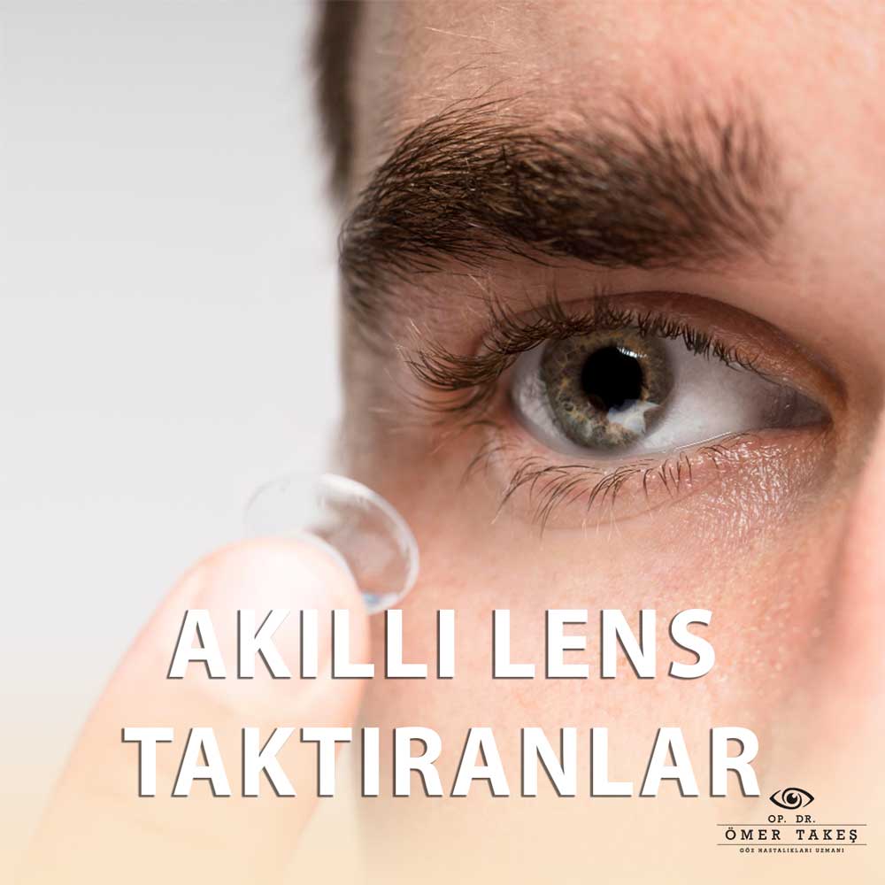 Akıllı Lens Taktıranların Yorumları ve Şikayetleri