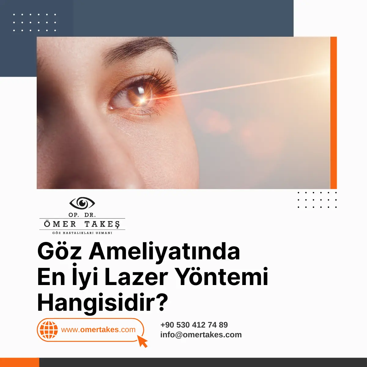 izmir göz çizdirme tavsiye