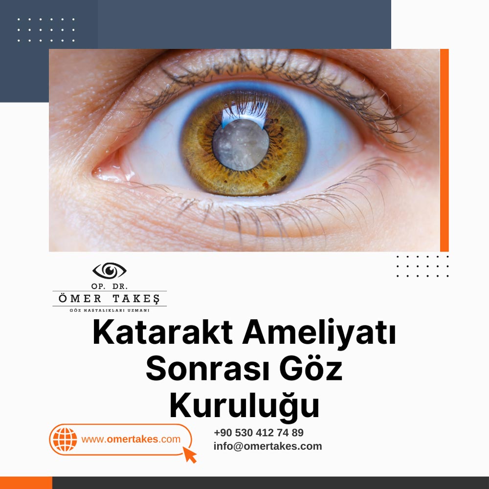 katarakt ameliyatı sonrası göz kuruluğu