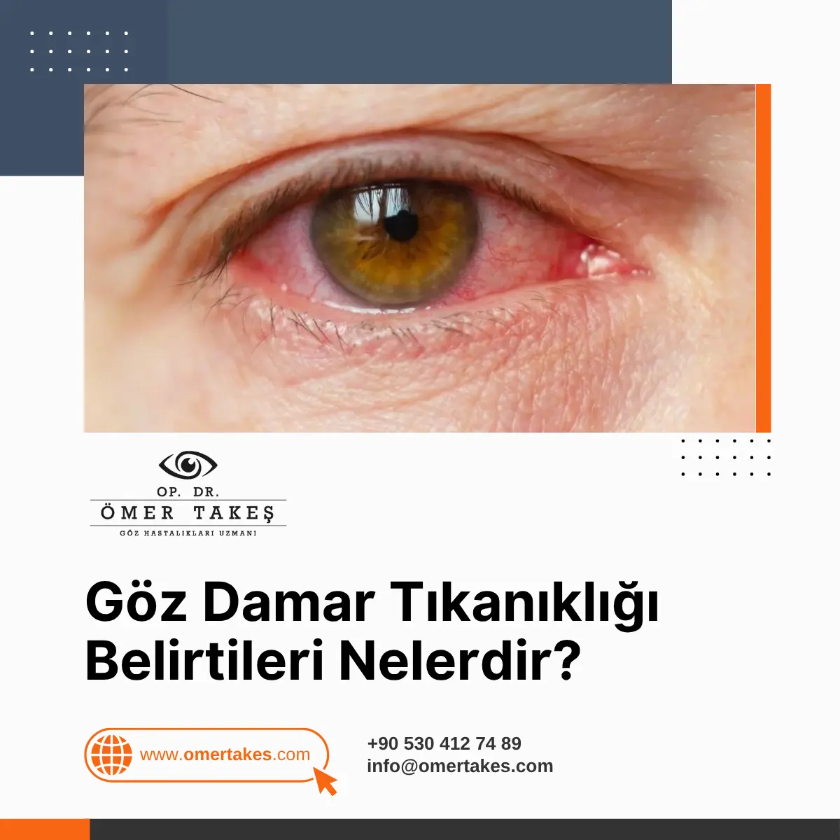 göz damar tıkanıklığı belirtileri