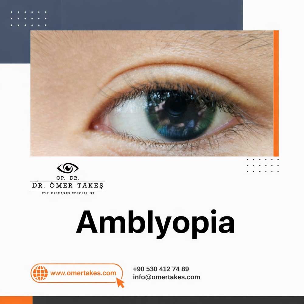 Causes of Amblyopia