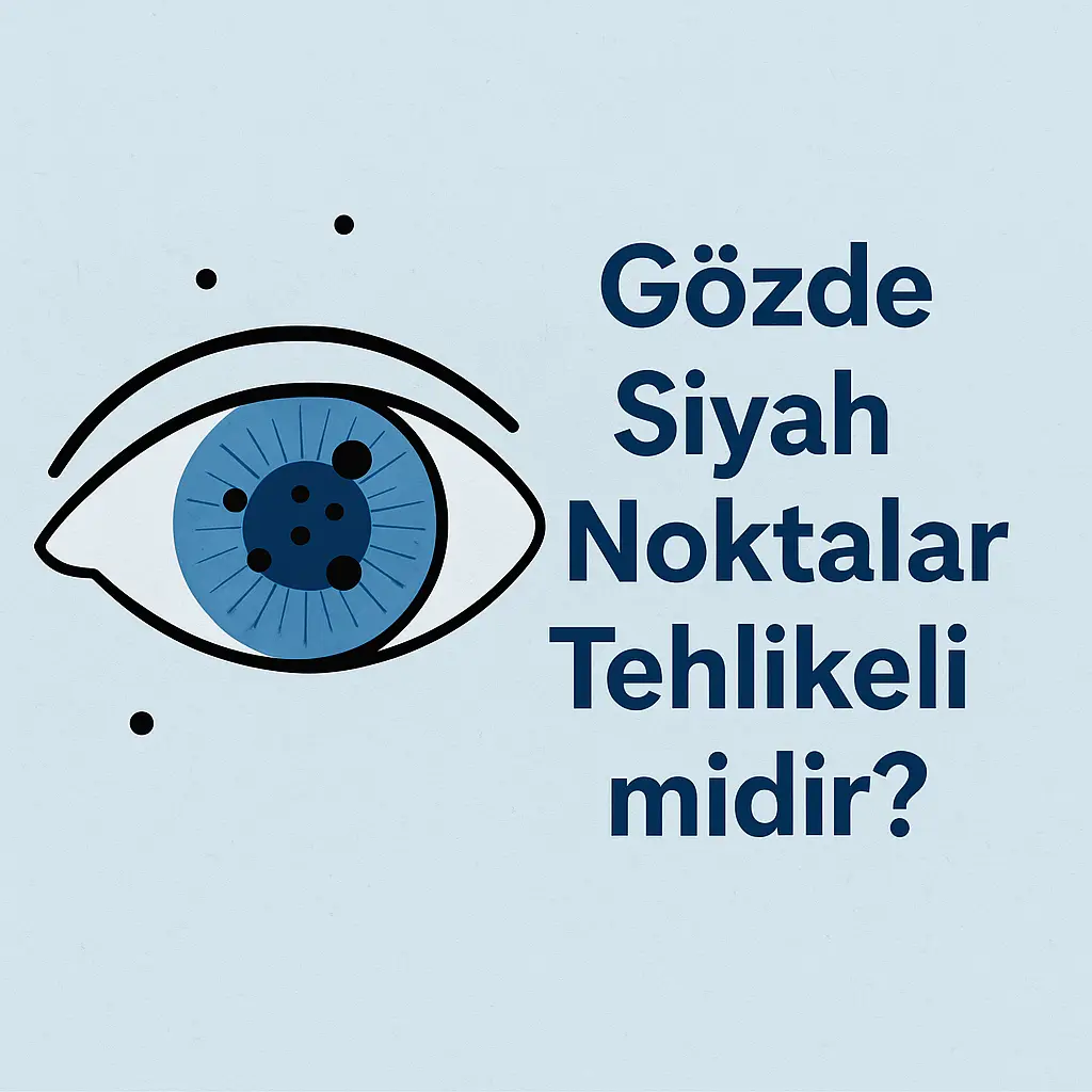Gözde Siyah Noktalar Tehlikeli mi