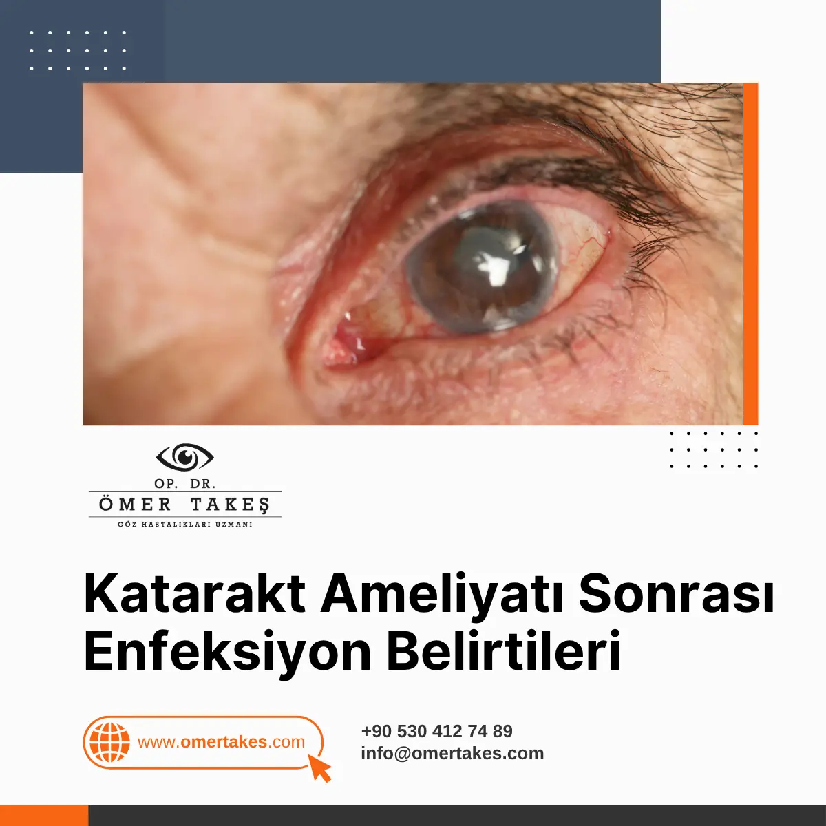 katarakt ameliyatı sonrası enfeksiyon belirtileri
