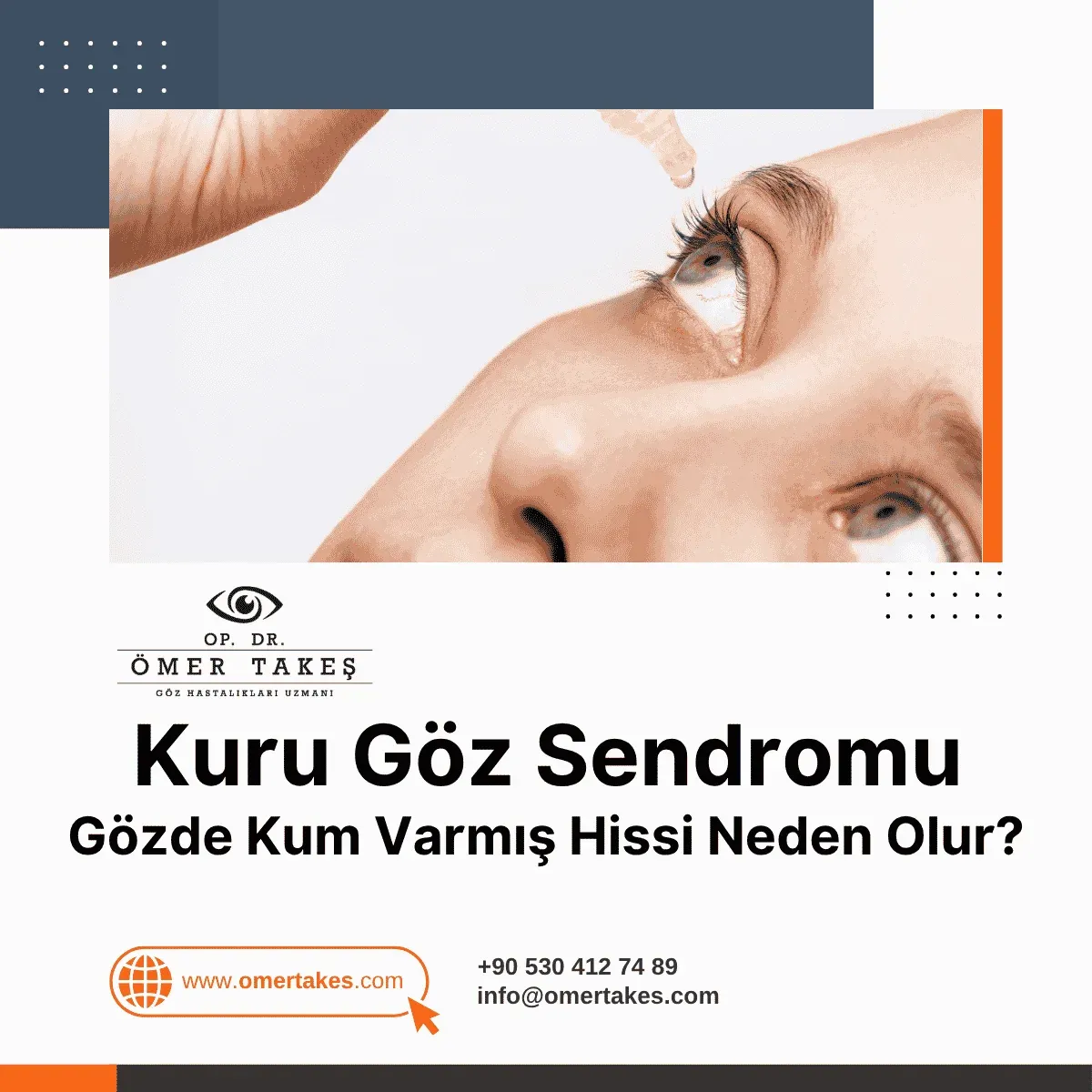 kuru göz sendromu nedir