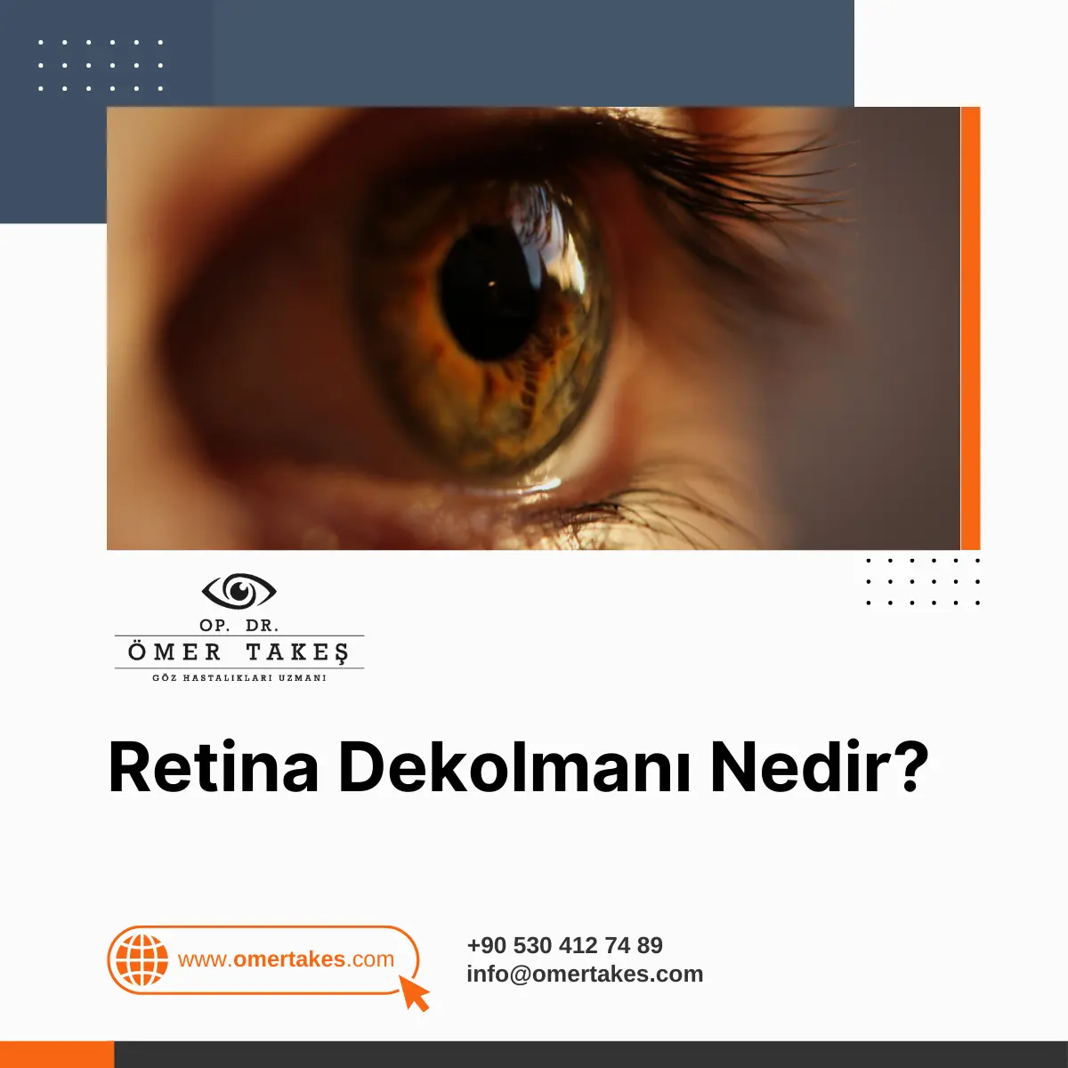 retina dekolmanı nedir