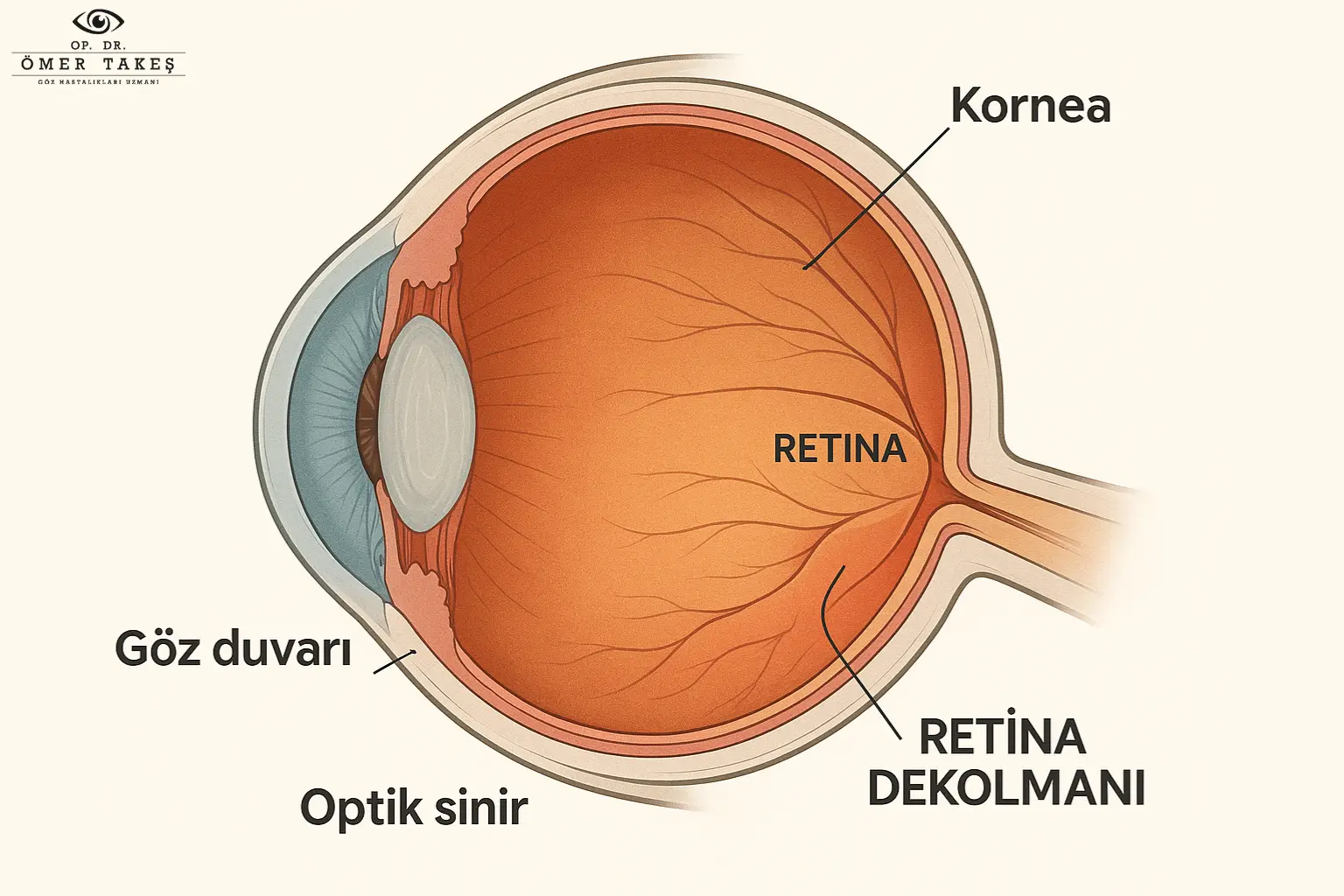 Retina ameliyatı sonrası yorumlar Kadınlar Kulübü, Retina ameliyatı sonrası bulanık görme